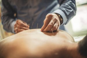 How Acupuncture Cures Muscle Pain