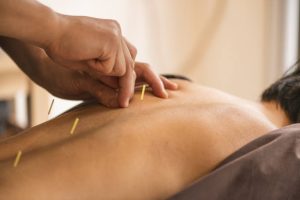 What To Avoid After An Acupuncture Treatment